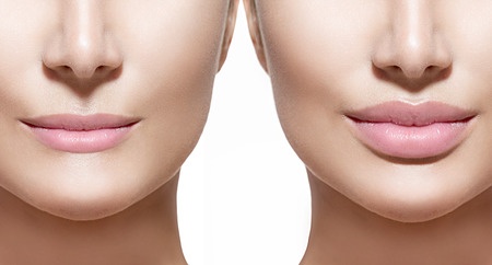 Увеличение объема губ с перманентный макияж губ thumbnail