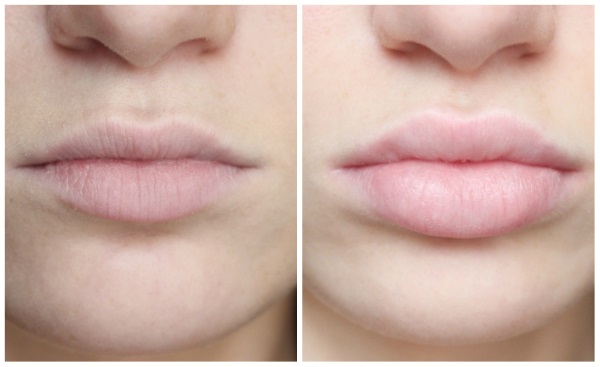 Изменить форму губ перманентный макияж thumbnail