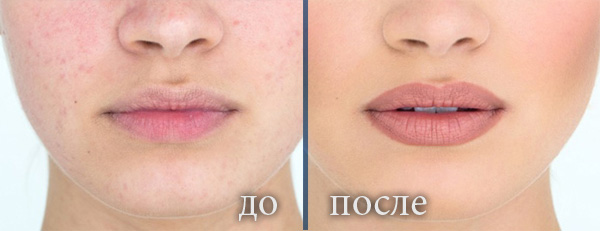 Татуаж губ: фото до и после, отзывы